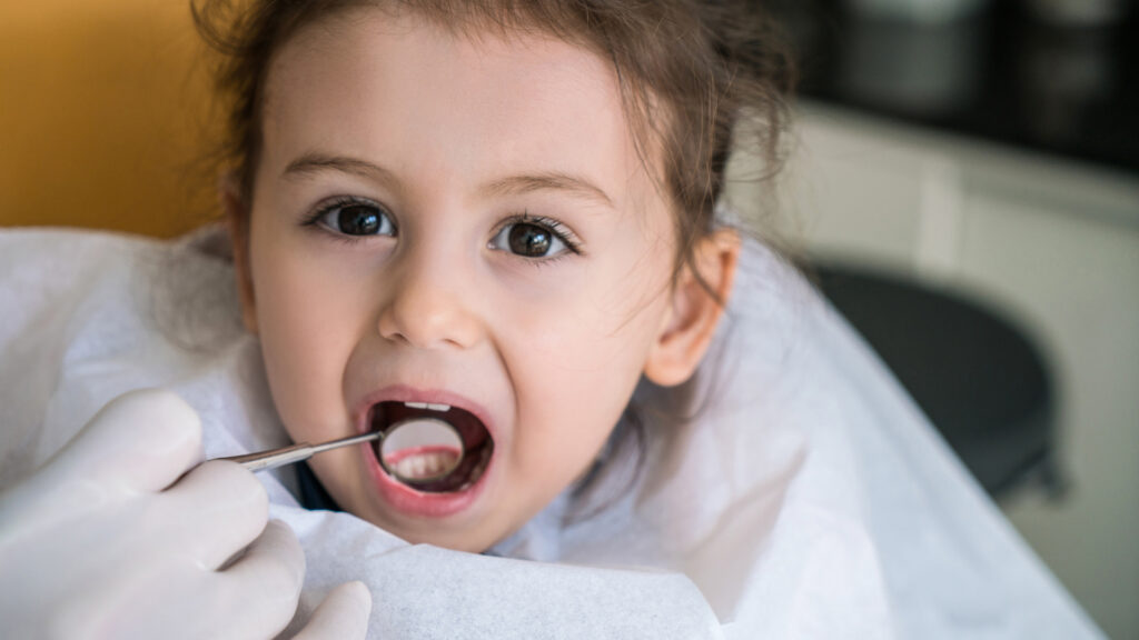 Fluoride Treatment Benefits for Children 4 Fluoride Treatment