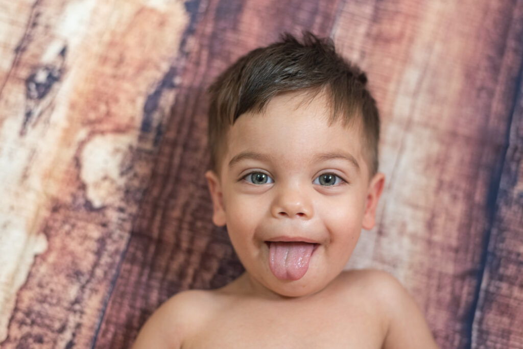 Has Your Baby Been Diagnosed With Tongue-Tie? 5 Baby Been Diagnosed With Tongue-Tie